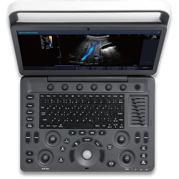 Echographe portable Sonoscape E2 Expert + 2 sondes – Rehamat Store